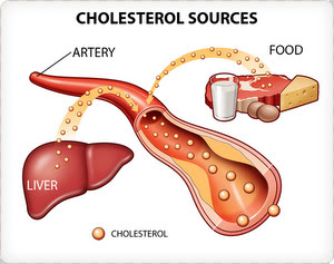 Obat Herbal CellMaxx Kolesterol Tinggi 