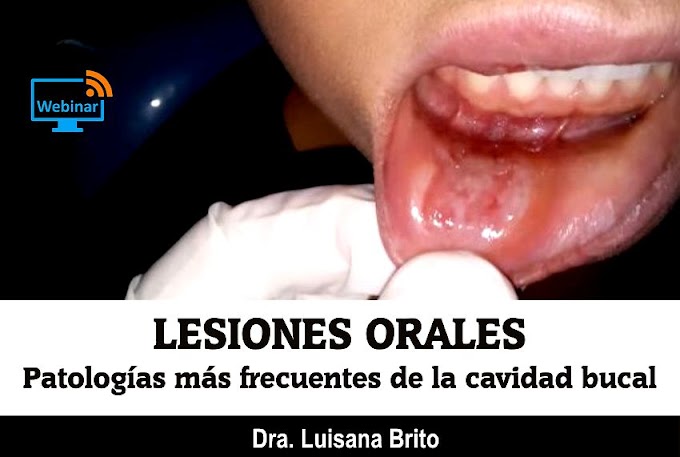 LESIONES ORALES: Patologías más frecuentes de la cavidad bucal - Dra. Luisana Brito