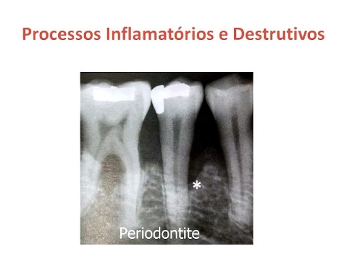 WEBINAR: Periodontia na atenção primária -  Rogério Carli Veloso