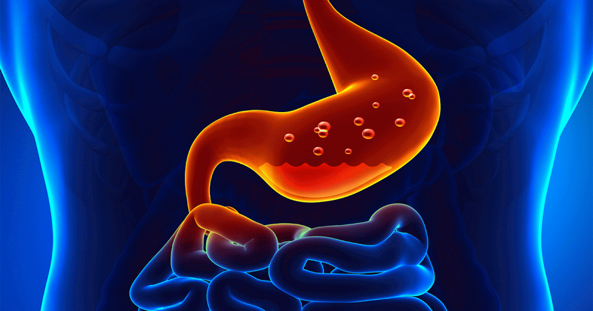 Gastritis síntomas, causas y tratamientos » Medical CalZeg Artículos