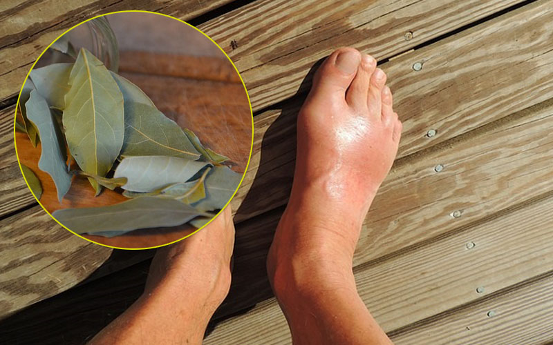 Dalam 2 Menit Asam Urat Sembuh Total, Kolesterol Turun Drastis Dengan Daun Salam Daun%2Bsalam