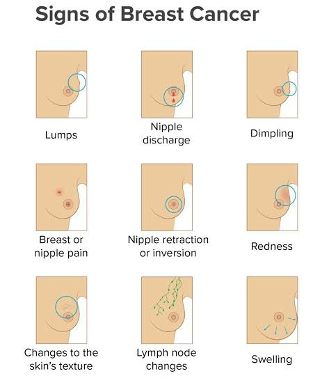 Breast Cancer symptoms and signs
