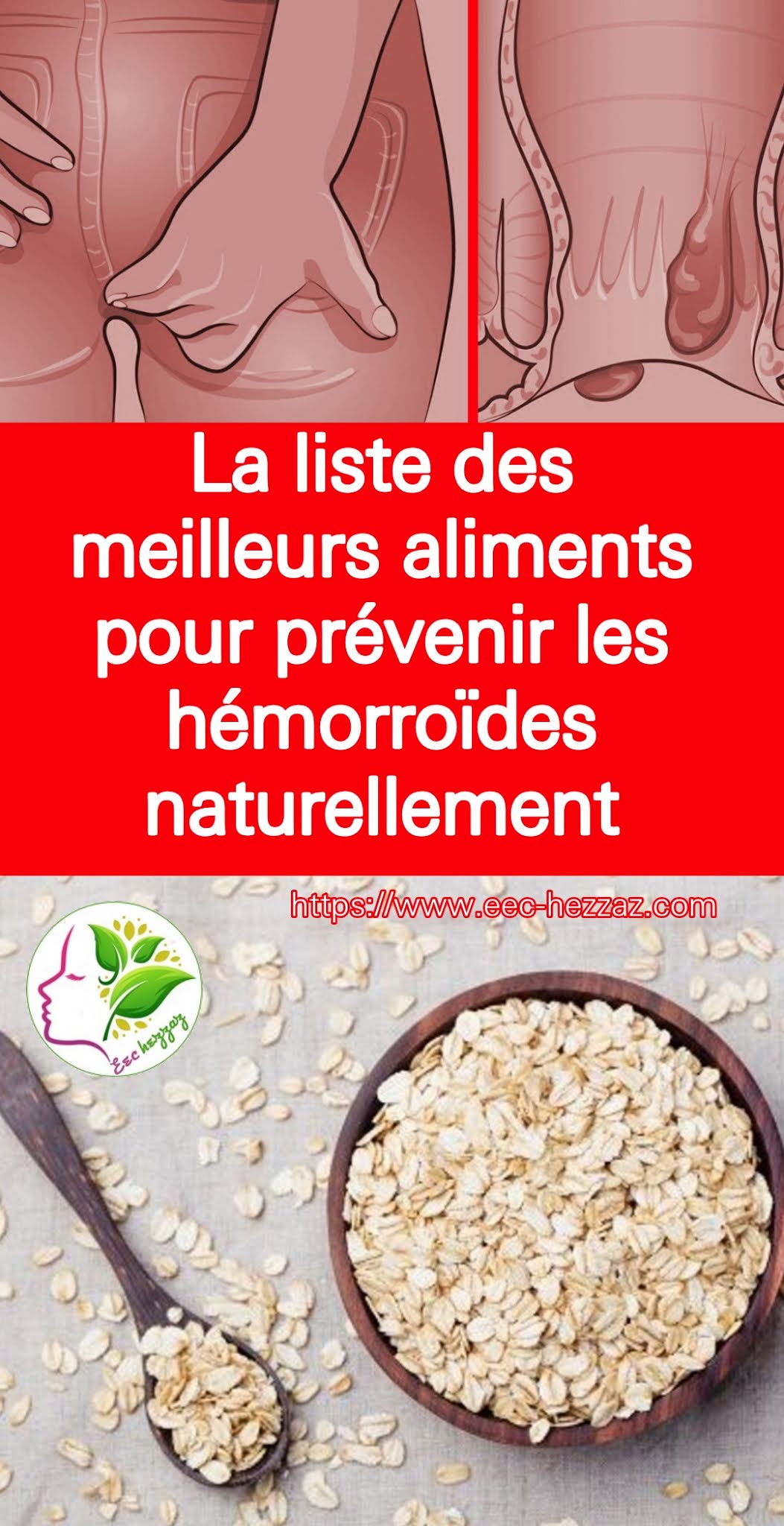 La liste des meilleurs aliments pour prévenir les hémorroïdes naturellement