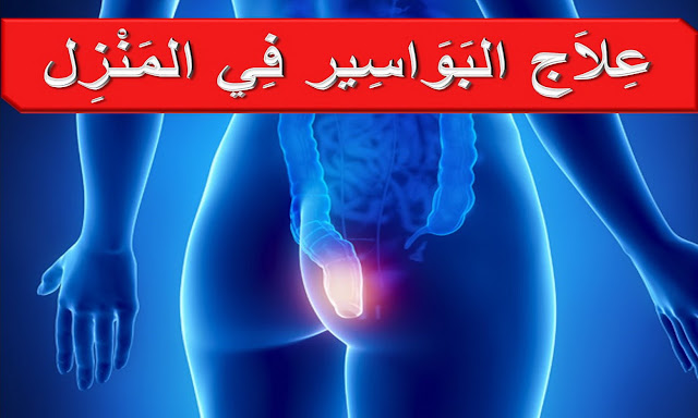 العلاج المنزلي السريع للبواسير