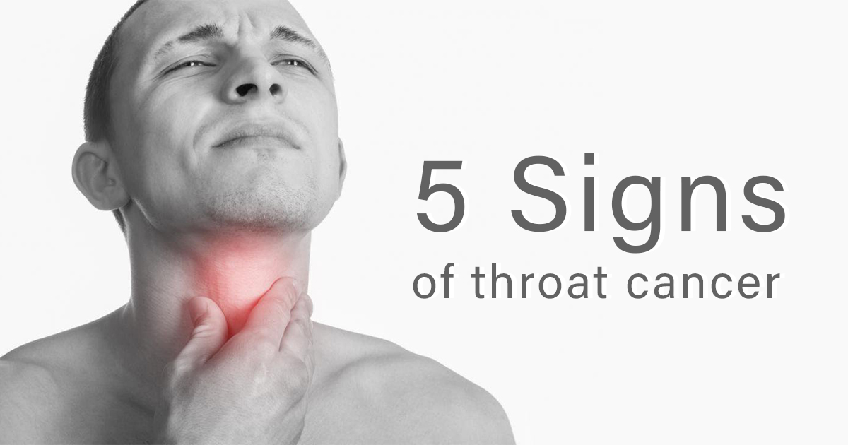 throat cancer research paper