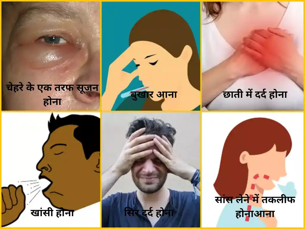 Black Fungus Infection (Mucormycosis): लक्षण, इलाज, कारण इत्यादि ब्लैक फंगस (म्युकर माइकोसिस)