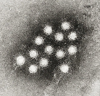 Hepatovirüs A virionlarının elektron mikrografisi