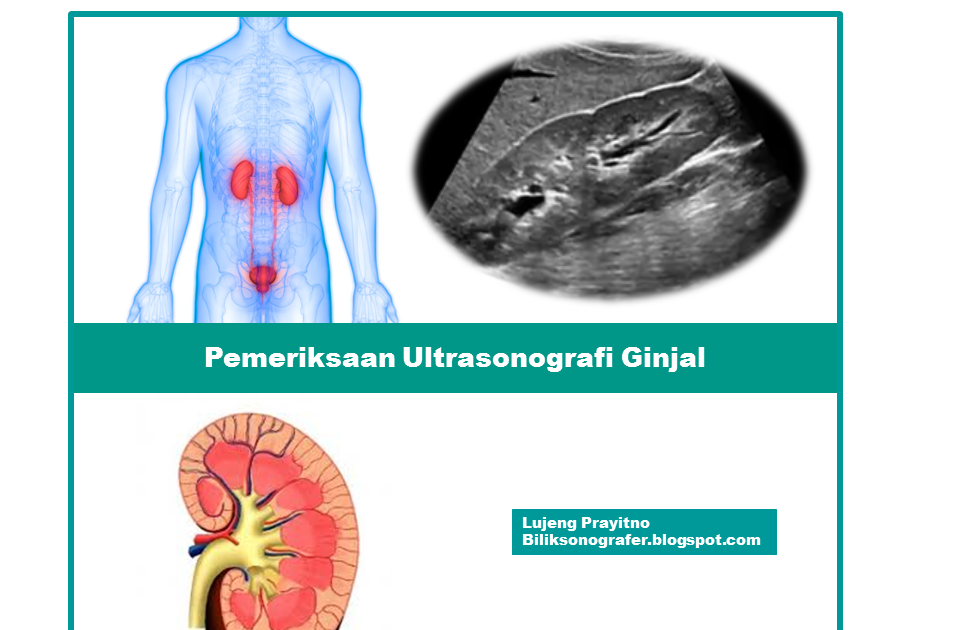 Pemeriksaan USG Ginjal