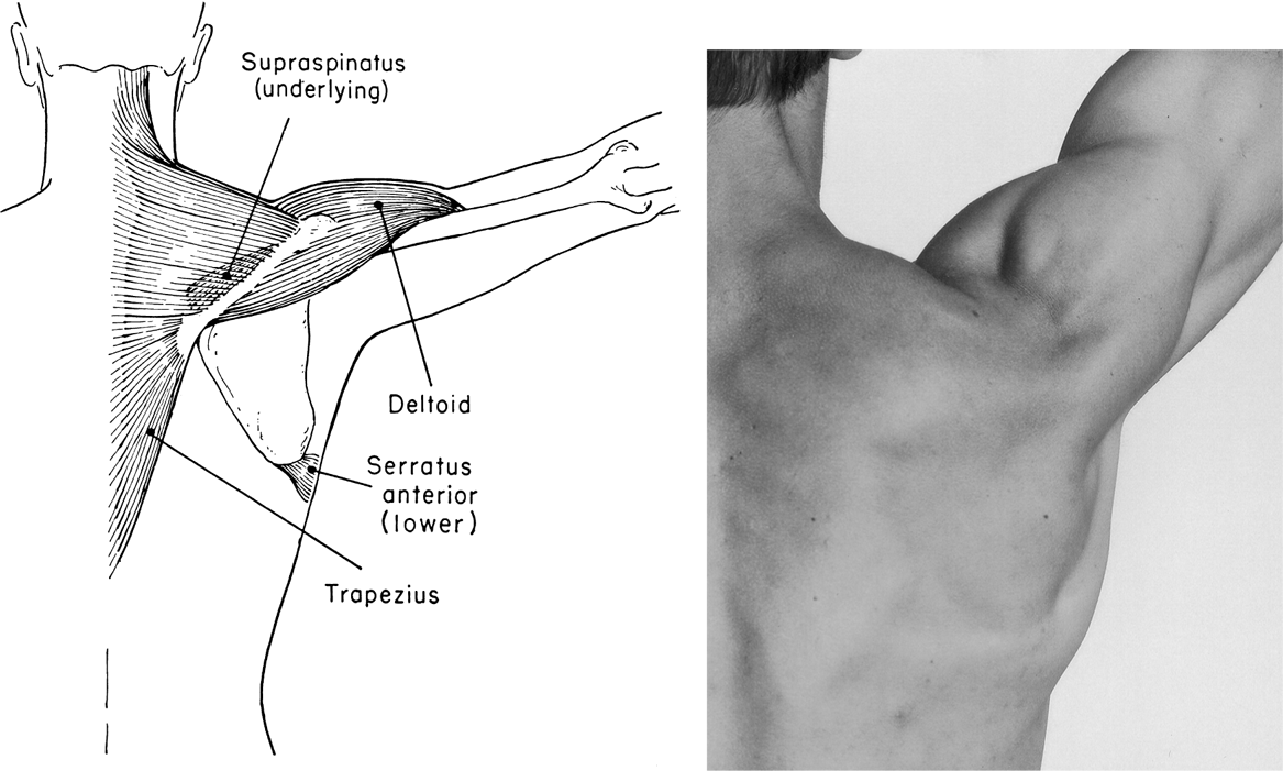 Schafer Chiropractic Rotator Cuff Injury Without Accident or Trauma