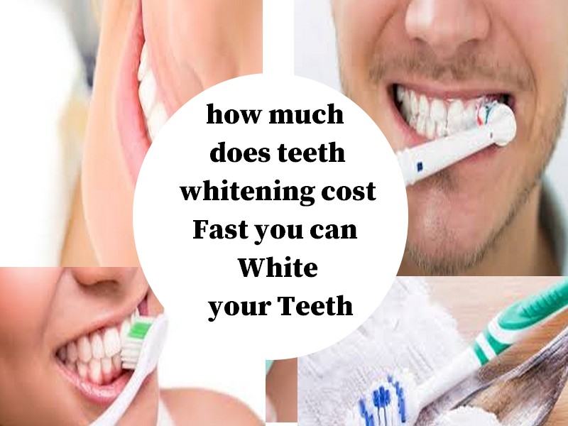 How To Teeth Whitening Naturally Keep your Teeth fresh Whiten Tips