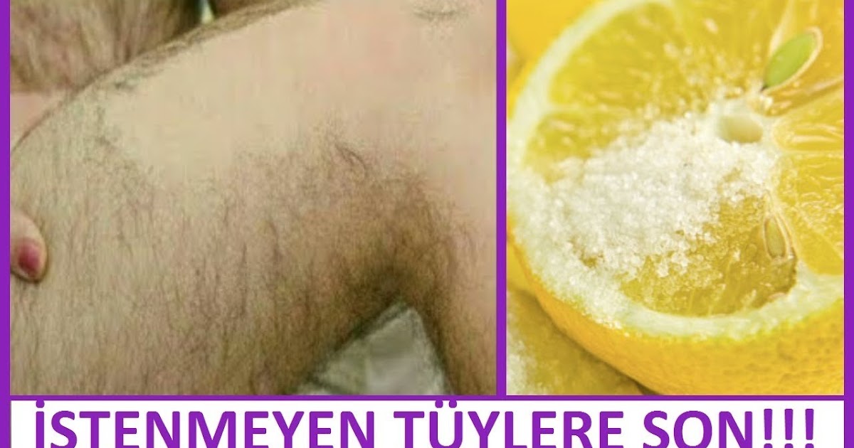 Yüzdeki Tüylerden Kurtulma Yüzdeki Tüyler Nasıl Yok Edilir Nasıl Gider