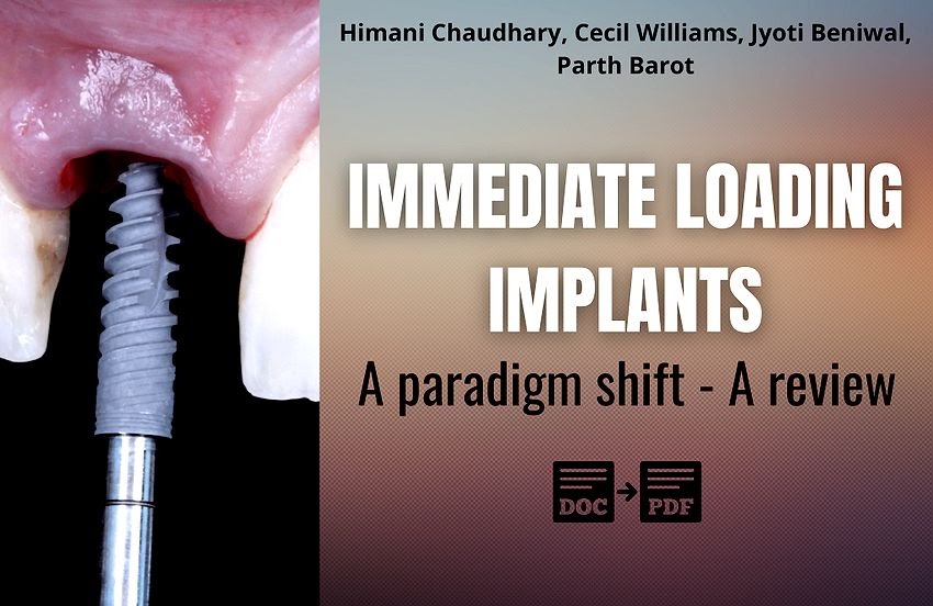 PDF Immediate Loading Implants A paradigm shift A review Ovi Dental