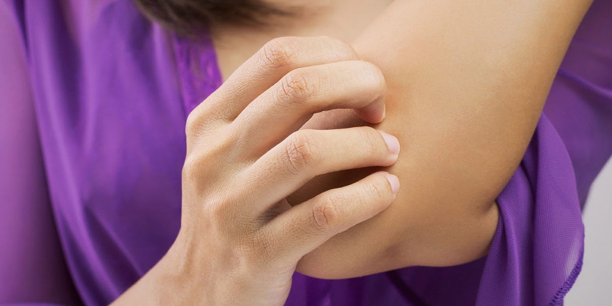 Common Types of Rashes