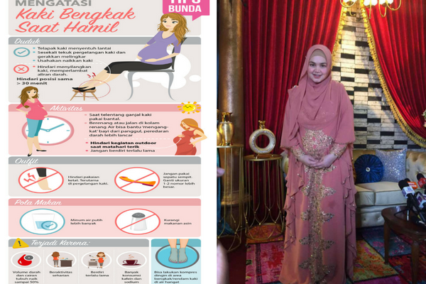 Kaki Siti Nurhalizah Bengkak Saat Hamil, Jika Anda Mengalami Begini Tipsnya Kaki Siti Nurhalizah Bengkak Saat Hamil, Jika Anda Mengalami Begini Tipsnya