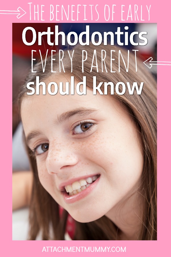 Orthodontics:  Here's several compelling reasons most parents aren't aware of to think about braces BEFORE the teen years.  #Orthodontics #Braces #Tweens #Preteens #Smile