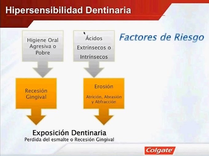 HIPERSENSIBILIDAD DENTINARIA: Manejo profesional - Dr. Antonio Cepeda Bravo