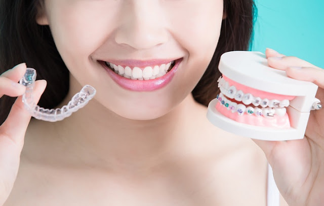 Best Orthodontist Melbourne