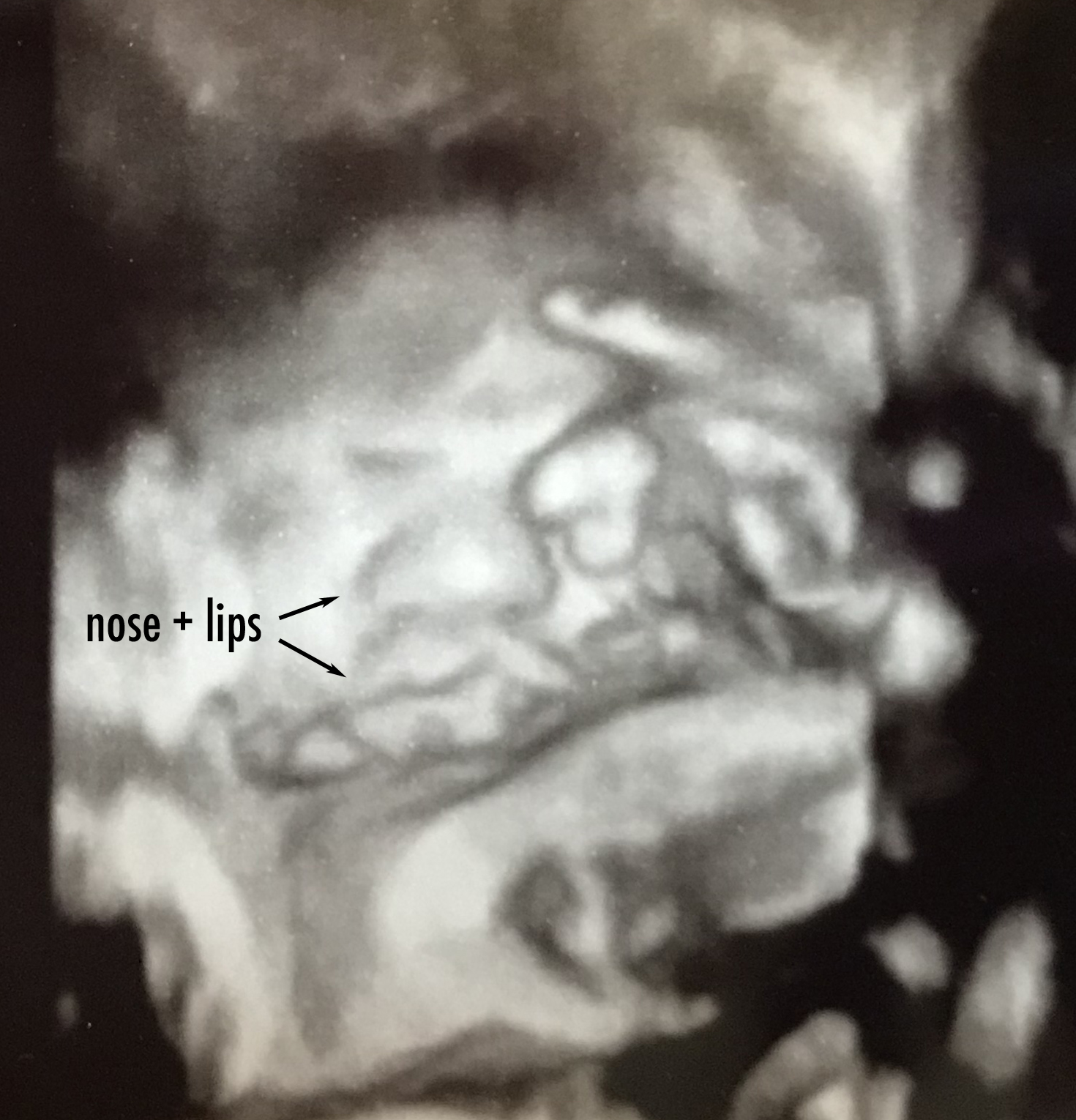 more than 9 to 5...my life as "Mom": Baby Bump Update: Week 36
