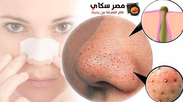 8 تشوهات فى بشرتك فما هو العلاج والوقاية Skin deformations ؟ 8 تشوهات فى بشرتك فما هو العلاج والوقاية Skin deformations ؟
