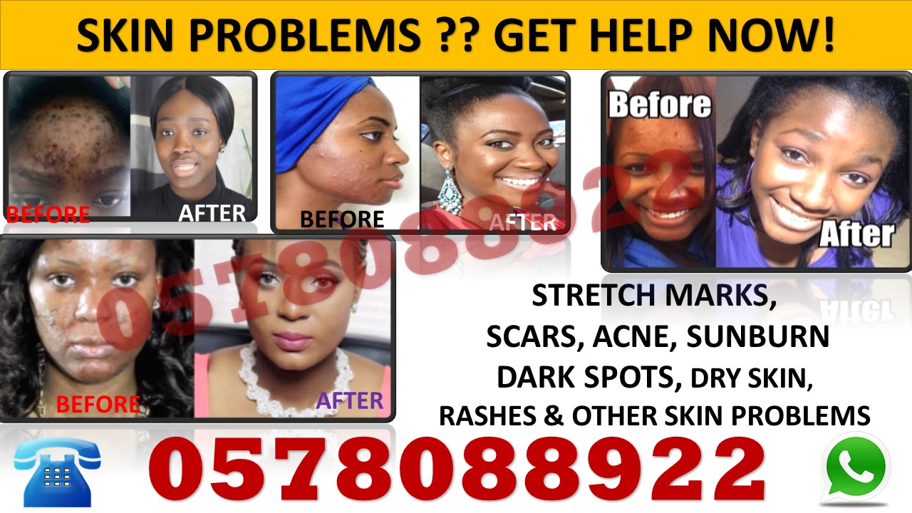 SKIN PROBLEM ? GET HELP NOW !