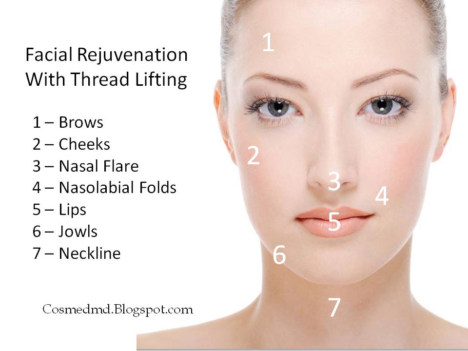 Cosmetic Medicine, MD: Thread Lifts - The No-Surgery Face Lifting  Alternative