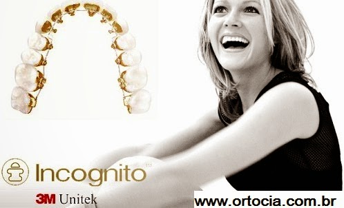 aparelho dental transparente aparelho dental transparente