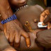 Зачем удаляют клитор. Женское обрезание в Африке. Женское обрезание в Сомали. Обрезание у женщин до и после.