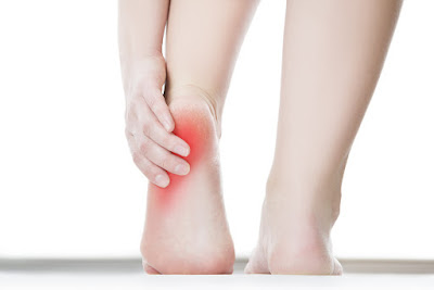 Biểu hiện của bệnh gai xương gót chân