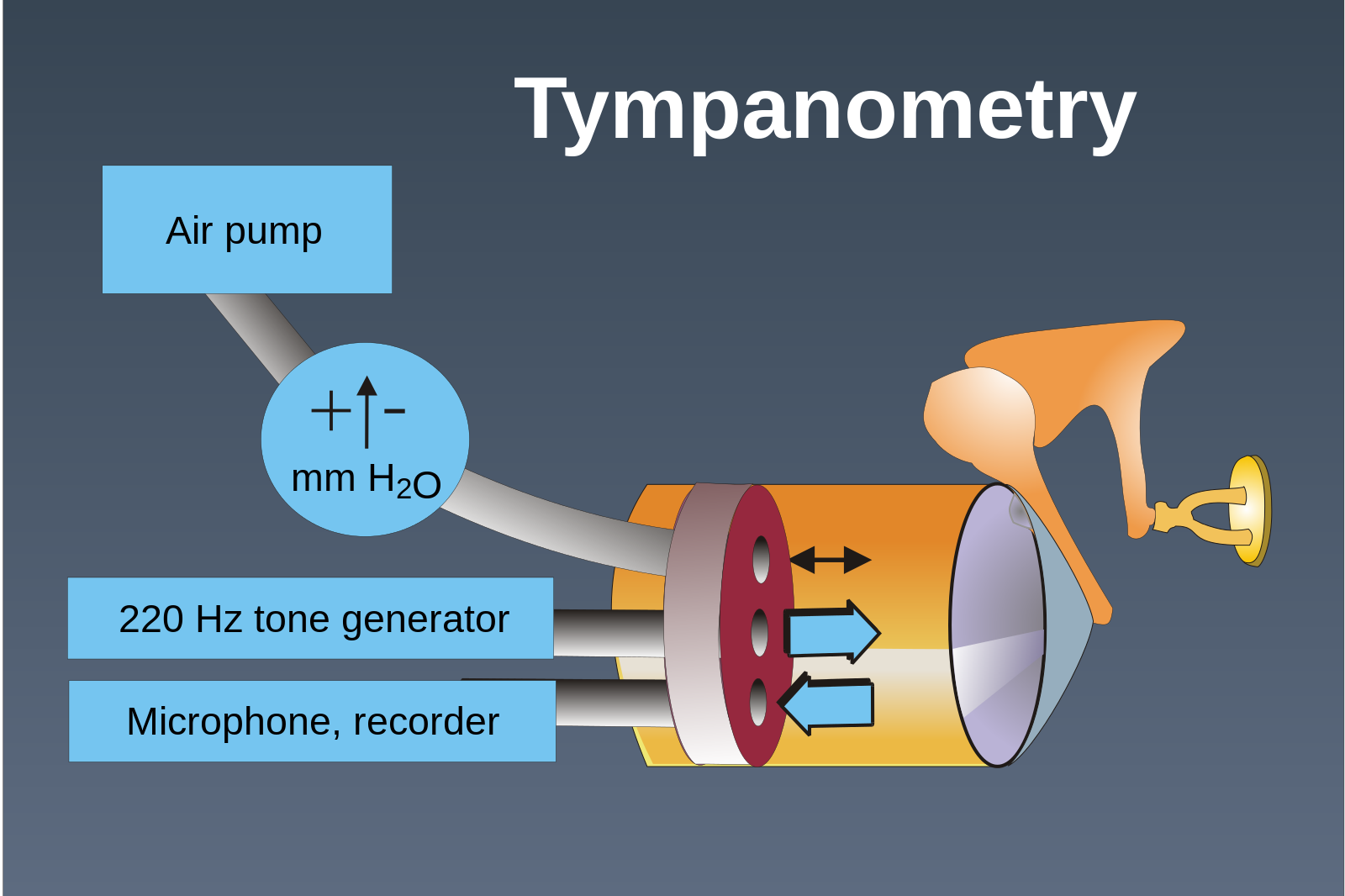 Types of Audiometric Tests