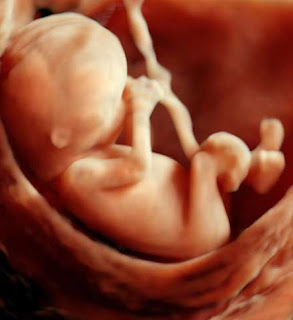 Ultrassom Revela Um Bebê No Útero Como Nunca Antes Visto 1 ultra+3d