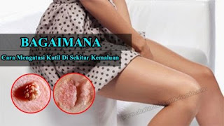Obat untuk kutil kelamin atau kutil di kemaluan, Obat Mengecilkan Benjolan Kutil Kelamin, Obat Medis Kutil Kelamin Atau Kutil Di Kemaluan, Obat Generik Untuk Kutil Kelamin Atau Kutil Di Kemaluan, Kutil Di Pangkal Kelamin, Obat Kutil Kelamin Atau Kutil Di Kemaluan Buat Ibu Hamil, Obat Kutil Kelamin Yang Tersedia Di Apotik, Obat Herbal Kutil Kelamin Atau Kutil Di Kemaluan Terbaik, Menghilangkan Kutil Kelamin Dengan Bawang Putih, Obat Pereda Sakit Kutil Kelamin, Obat Kutil Kelamin Yang Ampuh