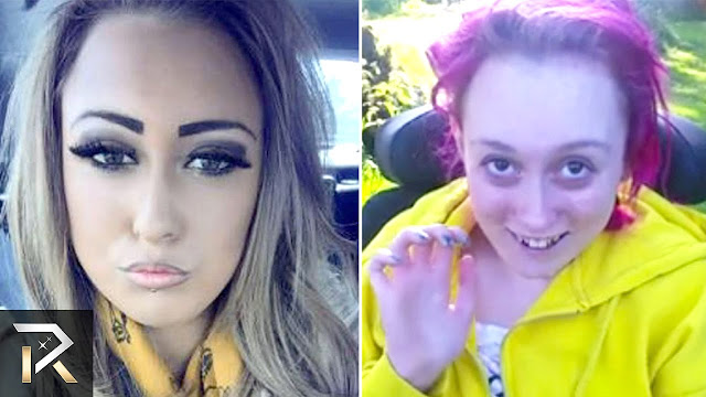 Shocking Vor-Nachher-Drug Use Fotos - Real Before and After