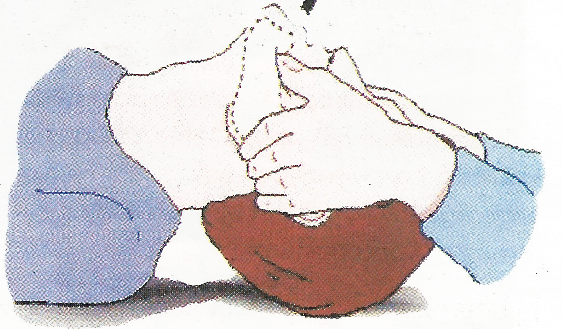 Bantuan Hidup Dasar & Resusitasi Jantung Paru (RJP) - Manajemen K3 Umum