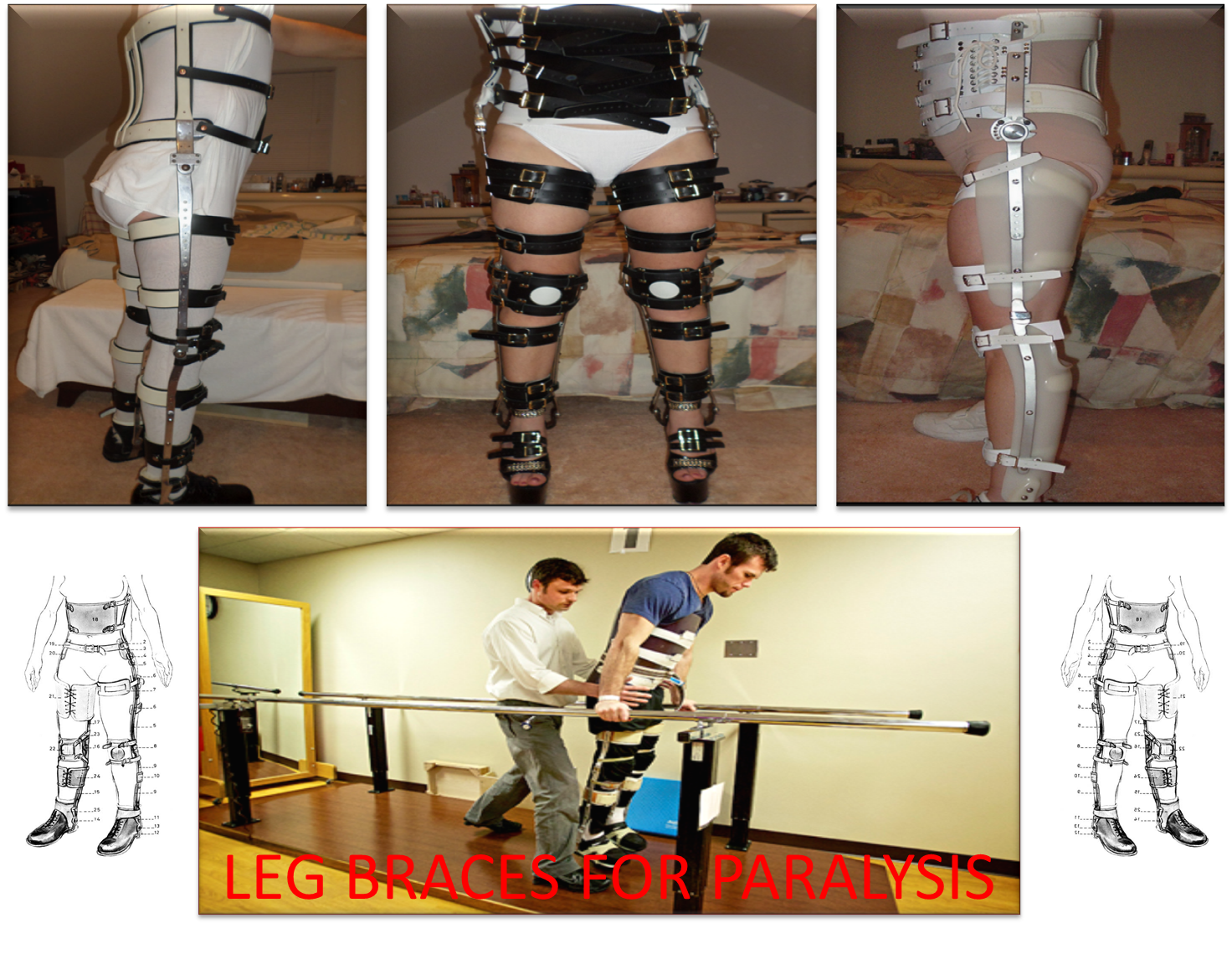 Leg Braces for (SCI)