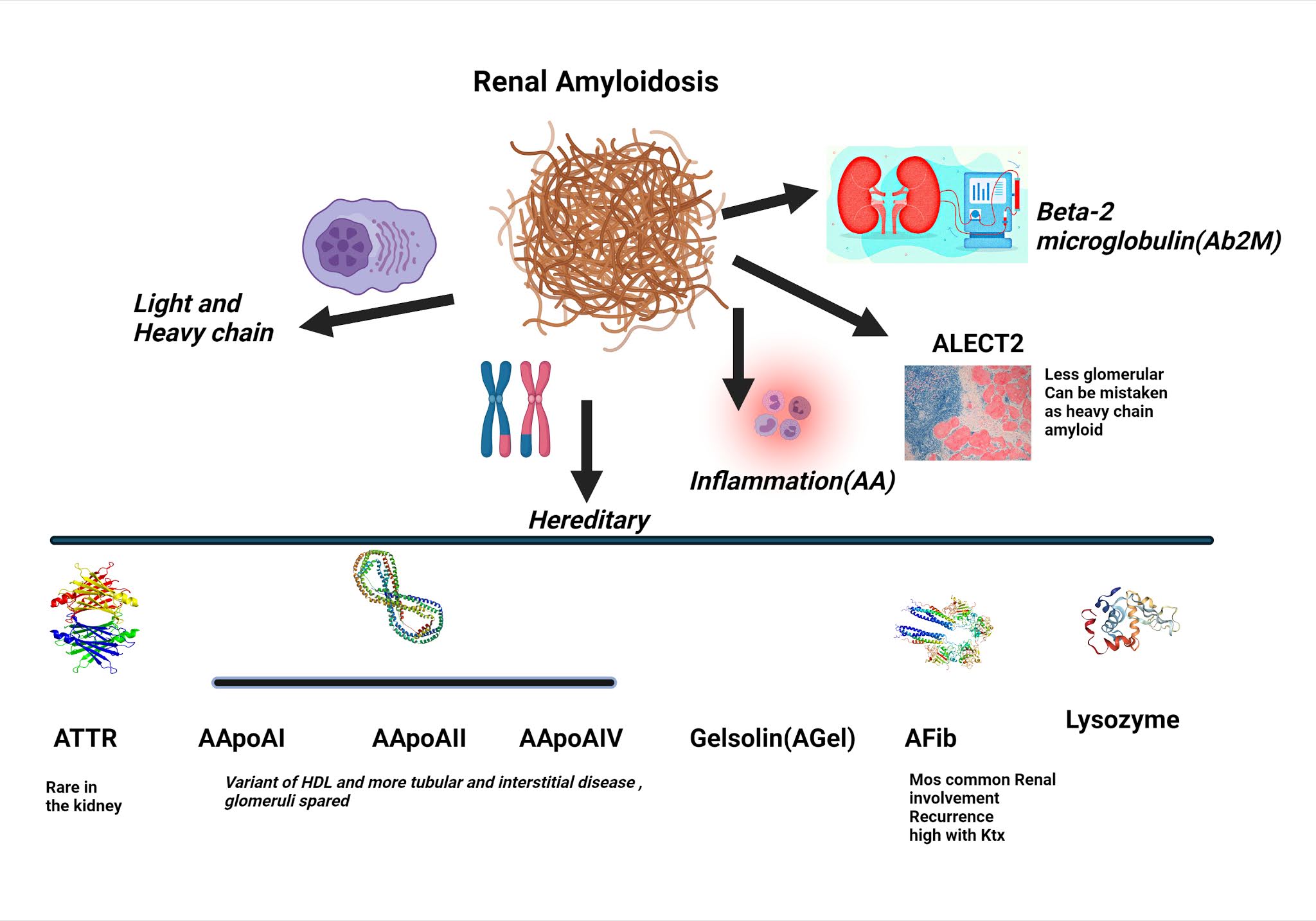 Nephron Power Concept Map Causes of Renal Amyloidosis
