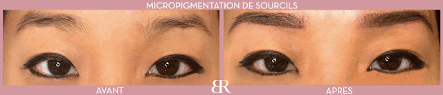 Les recettes simples du blanchiment de la personne