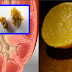 Simple Way On How To Flush Out Kidney Stones Using Lemons