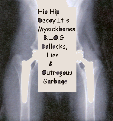 Hip Hip Decay it's MySickBones B.L.O.G  - Bollocks,      Lies & Outrageous Garbage