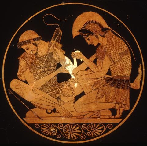 EL TAPANCO: AQUILES & PATROCLO