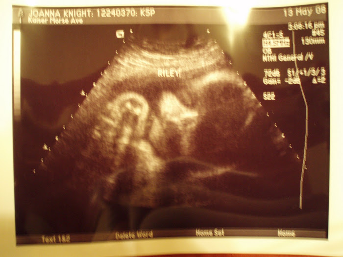 Front view of The Rhino :)