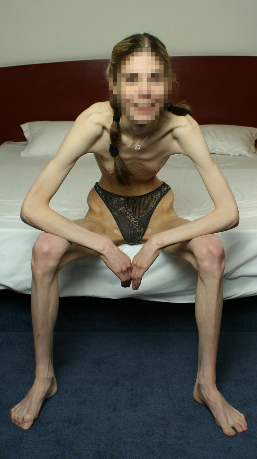 Anorexic Sexy Girs 9