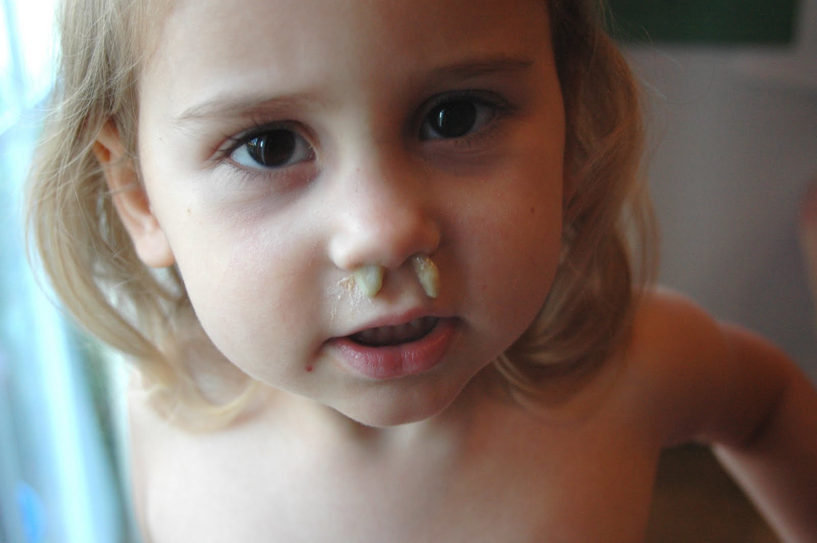 Засохшие сопли в носу. Стрептодермия в носу у ребенка. Козюлька из носа у ребенка.