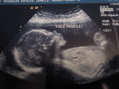 Our Baby Girl