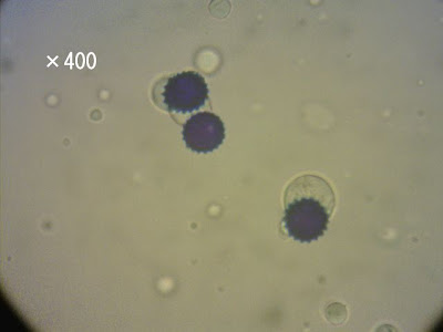 選択した画像 ブタクサ 花粉 顕微鏡 302981-ブタクサ 花粉 顕微鏡