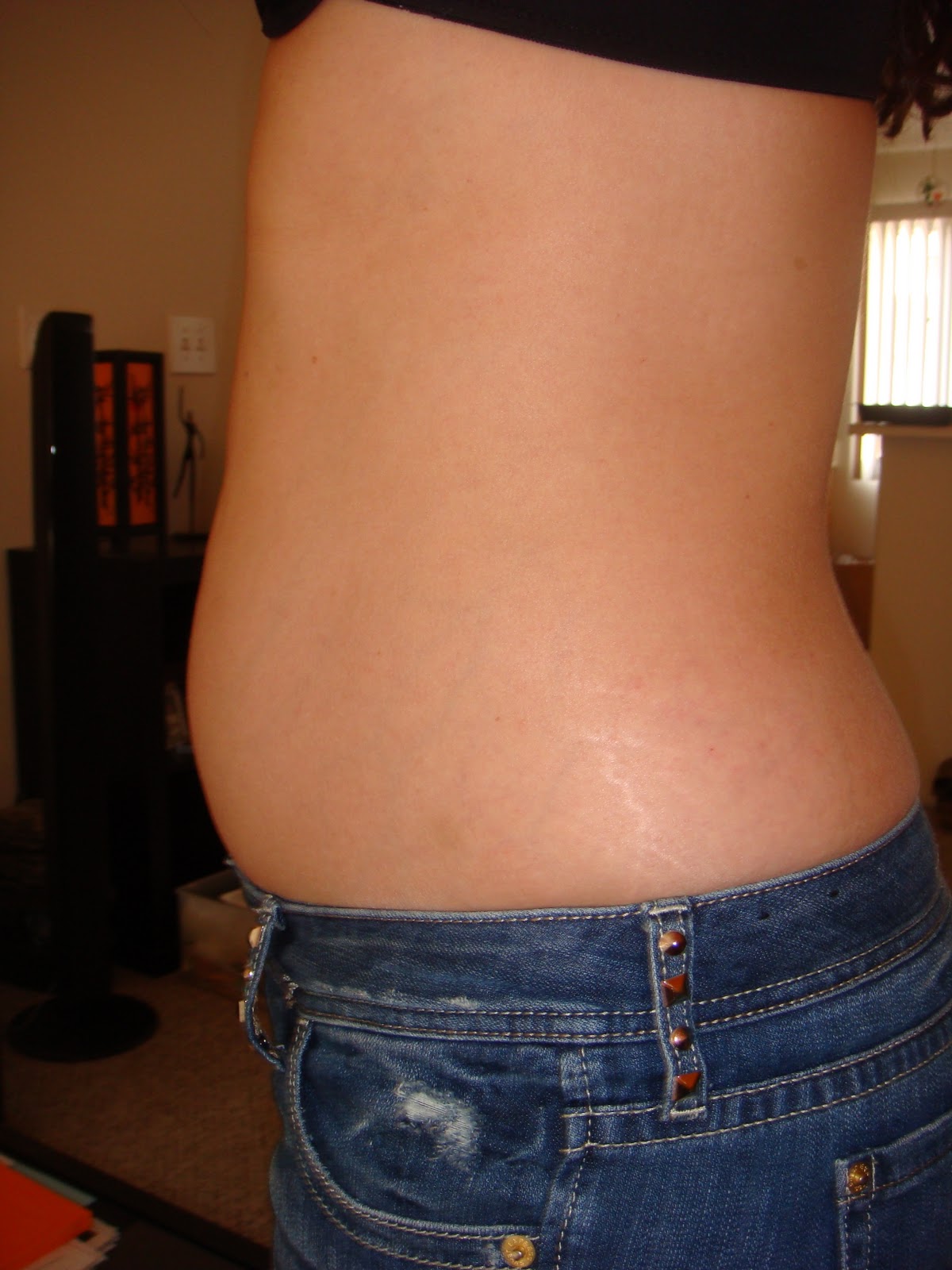 Days in the life of Dee Got Fibroids?