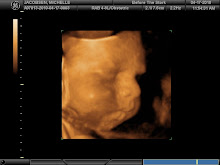 Cade's 28 Week 3D Ultrasound