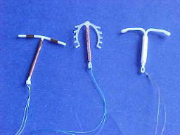 metodos-contraceptivos-diu-1.jpg