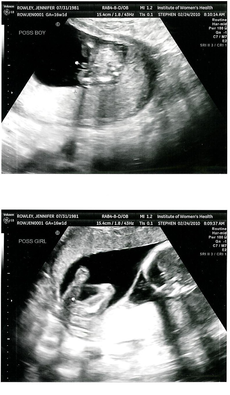 Growing Twins Ultrasound Pics