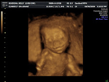Baby A 3D at 21 weeks