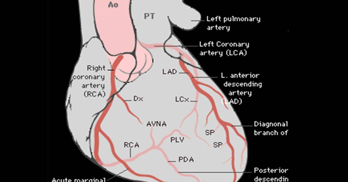 Labelled Diagram of the Coronary Arterial - Cancer ... cancer person diagram 